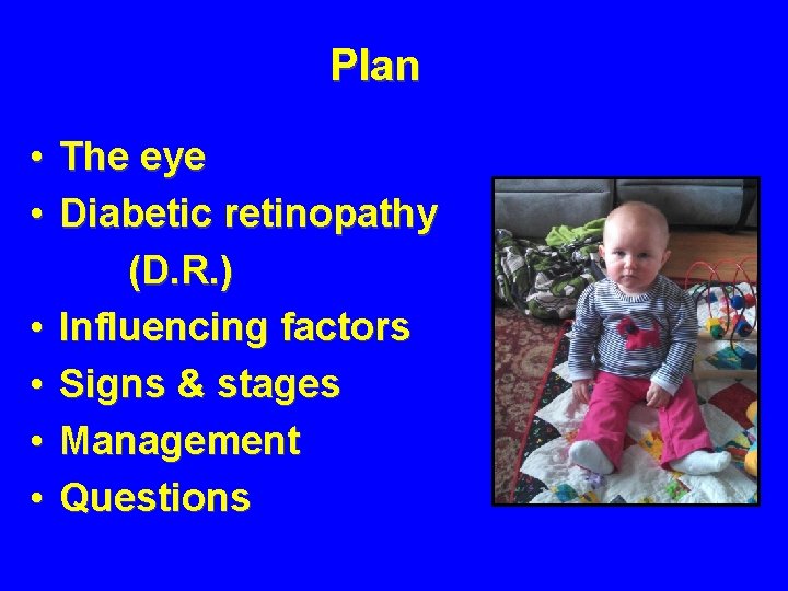 Plan • • • The eye Diabetic retinopathy (D. R. ) Influencing factors Signs