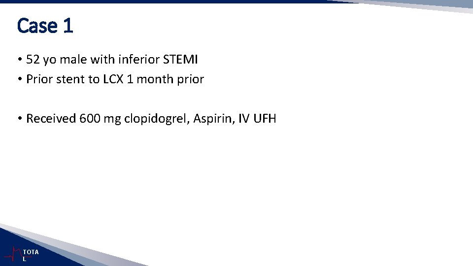 Case 1 • 52 yo male with inferior STEMI • Prior stent to LCX