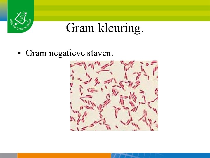 Gram kleuring. • Gram negatieve staven. 