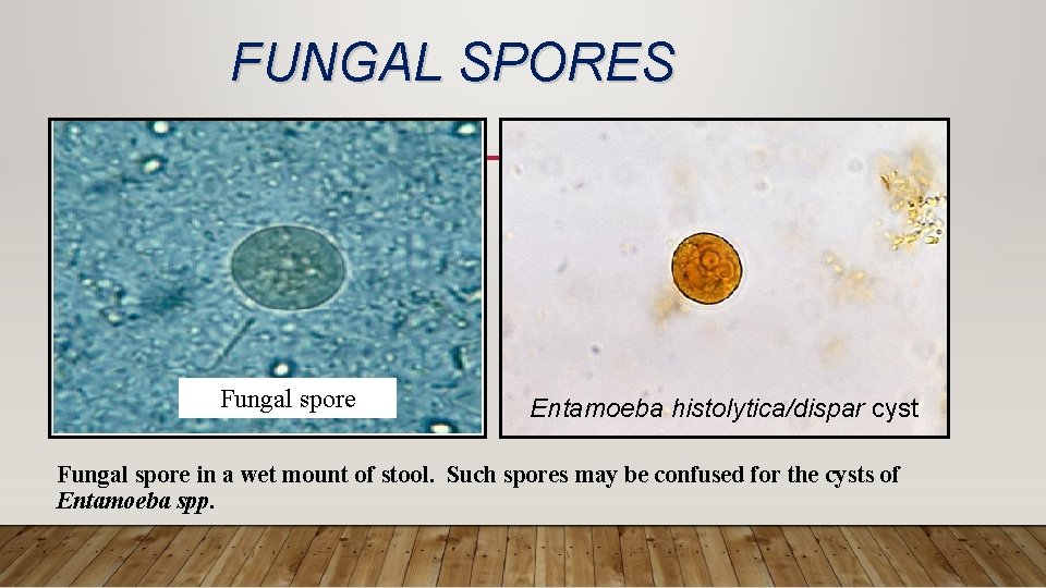 FUNGAL SPORES Fungal spore Entamoeba histolytica/dispar cyst Fungal spore in a wet mount of