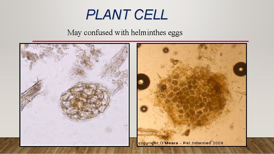 PLANT CELL May confused with helminthes eggs 