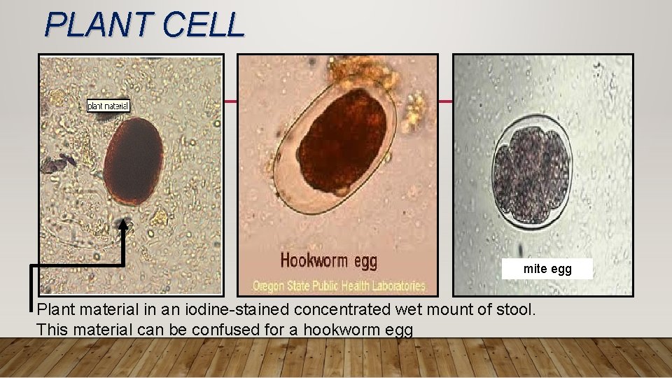 PLANT CELL mite egg Plant material in an iodine-stained concentrated wet mount of stool.