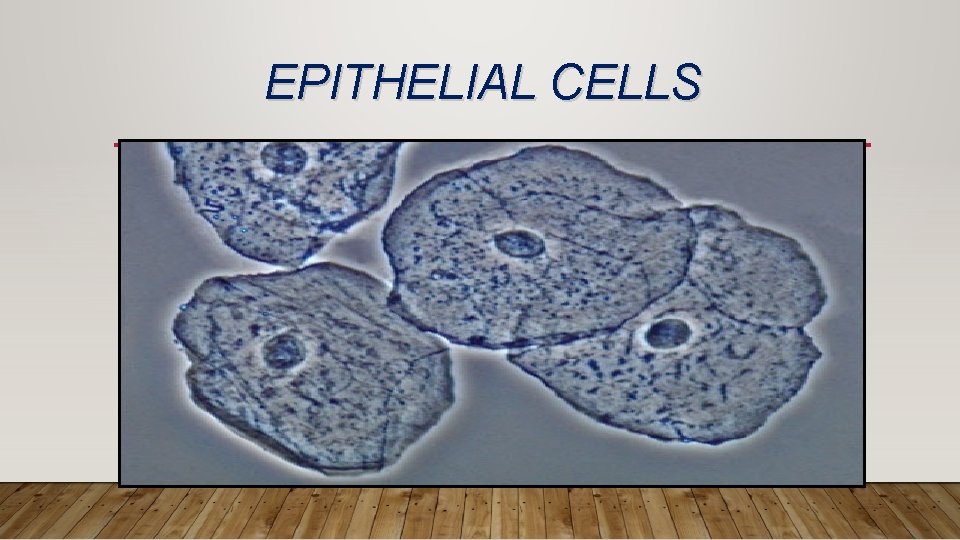 EPITHELIAL CELLS 