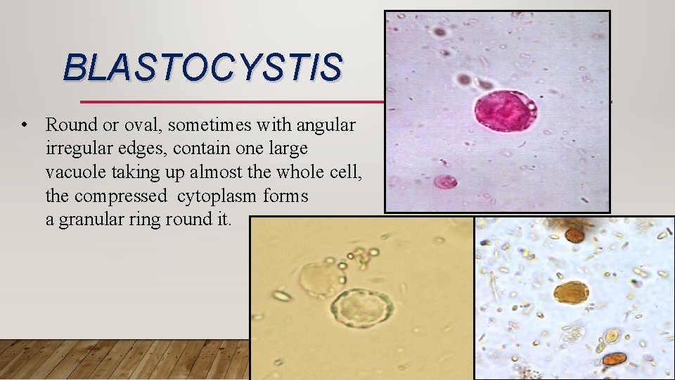 BLASTOCYSTIS • Round or oval, sometimes with angular irregular edges, contain one large vacuole