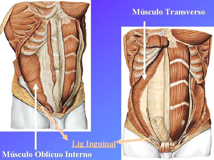 Músculo Transverso Lig Inguinal Músculo Oblicuo Interno 