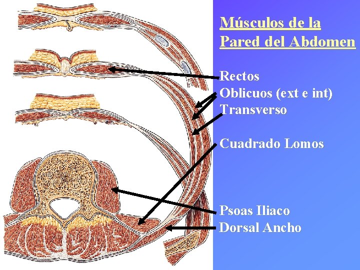 Músculos de la Pared del Abdomen Rectos Oblicuos (ext e int) Transverso Cuadrado Lomos