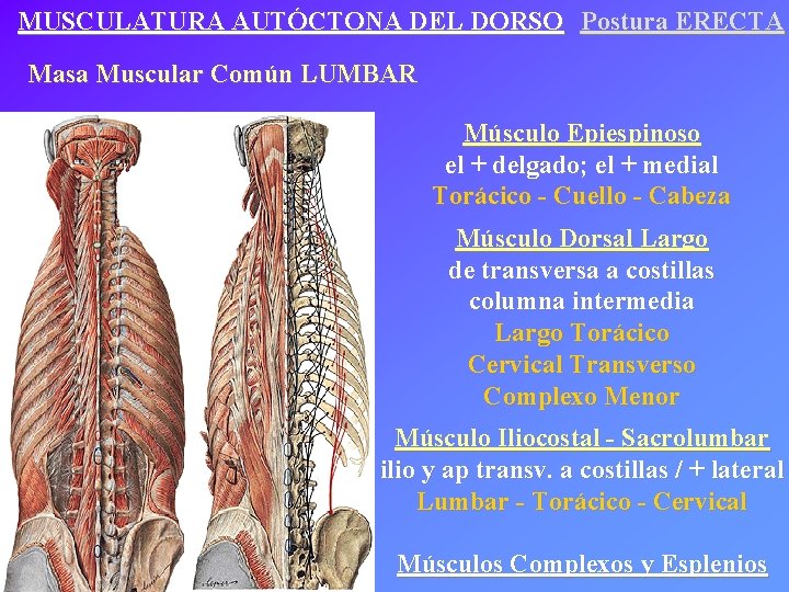 MUSCULATURA AUTÓCTONA DEL DORSO Postura ERECTA Masa Muscular Común LUMBAR Músculo Epiespinoso el +