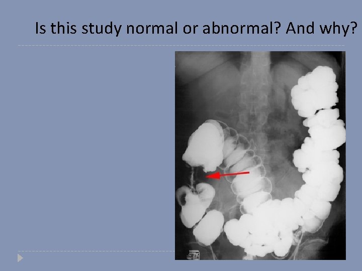 Is this study normal or abnormal? And why? 