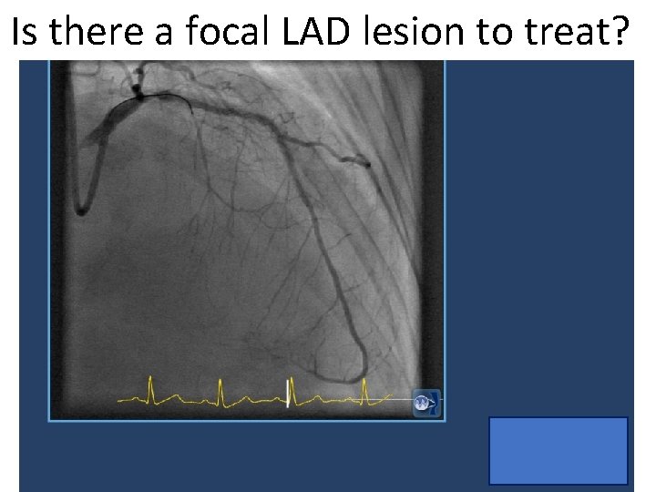 Is there a focal LAD lesion to treat? 