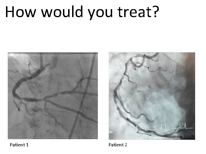 How would you treat? Patient 1 Patient 2 