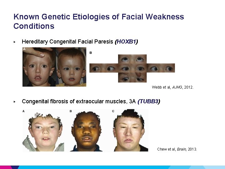 Known Genetic Etiologies of Facial Weakness Conditions ▶ Hereditary Congenital Facial Paresis (HOXB 1)