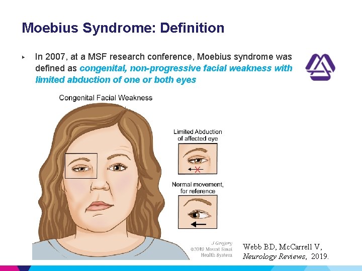 Moebius Syndrome: Definition ▶ In 2007, at a MSF research conference, Moebius syndrome was