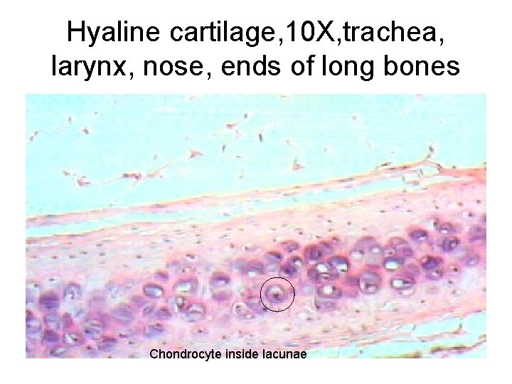 Hyaline cartilage, 10 X, trachea, larynx, nose, ends of long bones Chondrocyte inside lacunae Hyaline cartilage, 10 X, trachea, larynx, nose, ends of long bones Chondrocyte inside lacunae