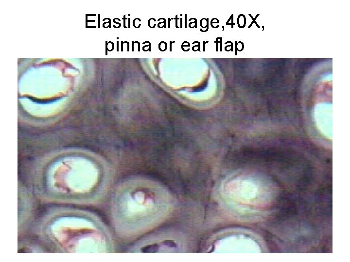 Elastic cartilage, 40 X, pinna or ear flap 