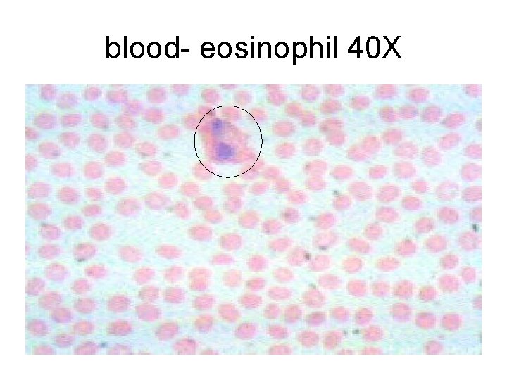 blood- eosinophil 40 X blood- eosinophil 40 X