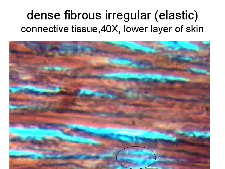 dense fibrous irregular (elastic) connective tissue, 40 X, lower layer of skin 