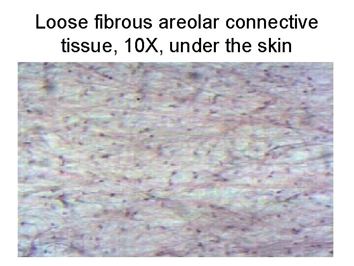 Loose fibrous areolar connective tissue, 10 X, under the skin Loose fibrous areolar connective tissue, 10 X, under the skin