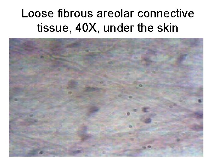 Loose fibrous areolar connective tissue, 40 X, under the skin Loose fibrous areolar connective tissue, 40 X, under the skin