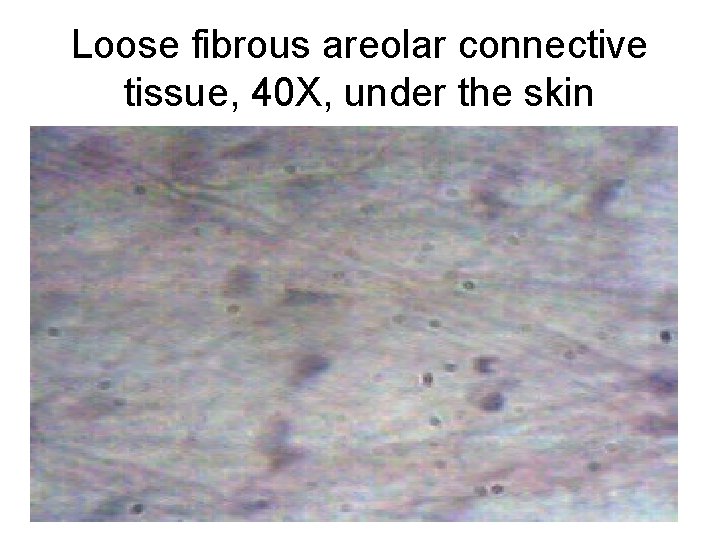 Loose fibrous areolar connective tissue, 40 X, under the skin 