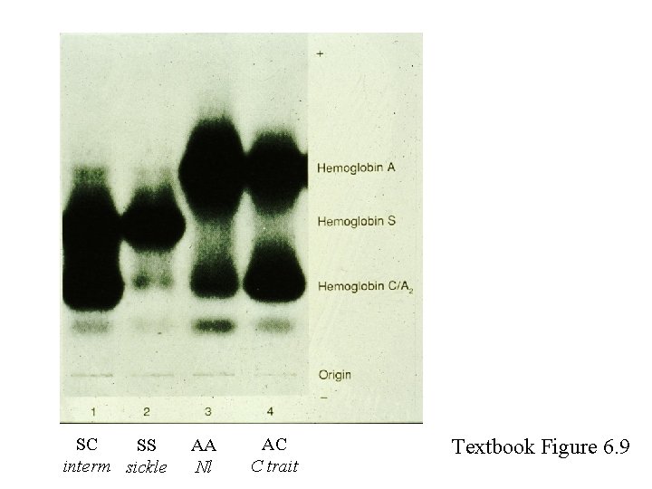 SC SS interm sickle AA Nl AC C trait Textbook Figure 6. 9 