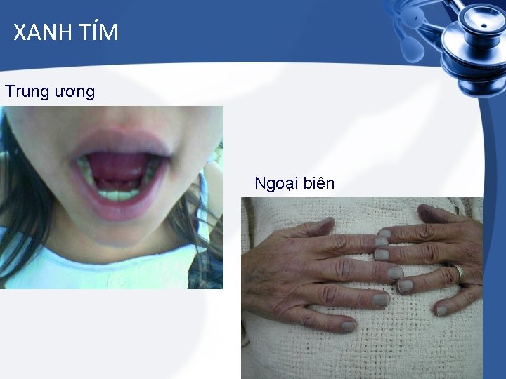 XANH TÍM Trung ương Ngoại biên 