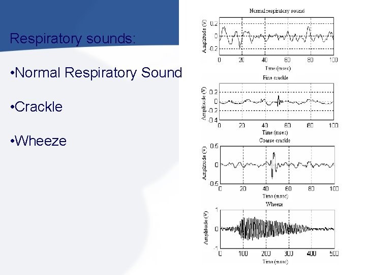 Respiratory sounds: • Normal Respiratory Sound • Crackle • Wheeze 
