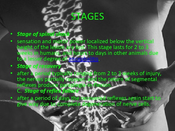 STAGES • Stage of spinal shock • sensation and motor power localized below the