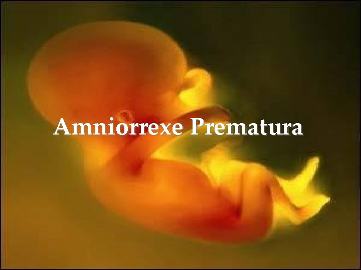 Amniorrexe Prematura 