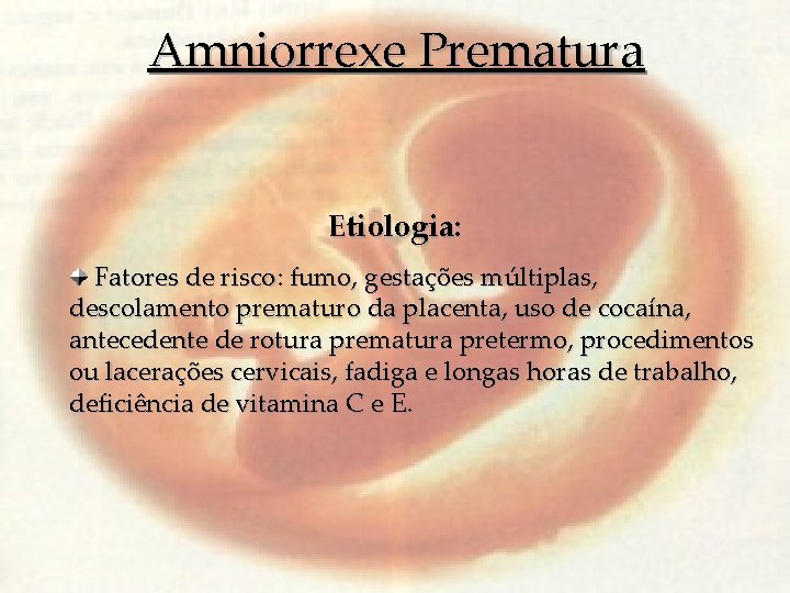 Amniorrexe Prematura Etiologia: Fatores de risco: fumo, gestações múltiplas, descolamento prematuro da placenta, uso