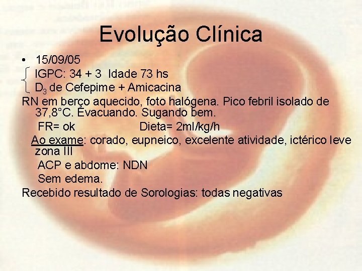 Evolução Clínica • 15/09/05 IGPC: 34 + 3 Idade 73 hs D 3 de