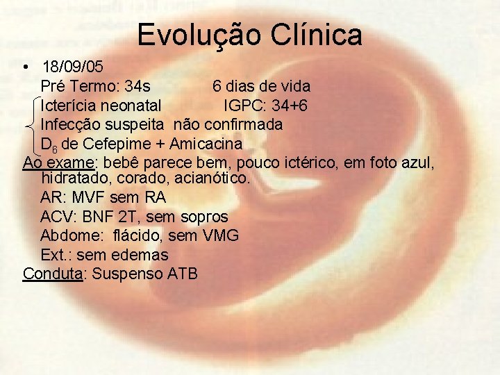 Evolução Clínica • 18/09/05 Pré Termo: 34 s 6 dias de vida Icterícia neonatal