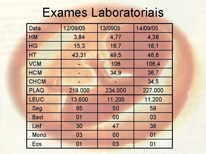 Exames Laboratoriais Data 12/09/05 13/0905 14/09/05 HM 3, 84 4, 77 4, 38 HG