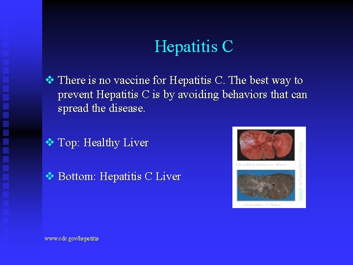 Hepatitis C v There is no vaccine for Hepatitis C. The best way to