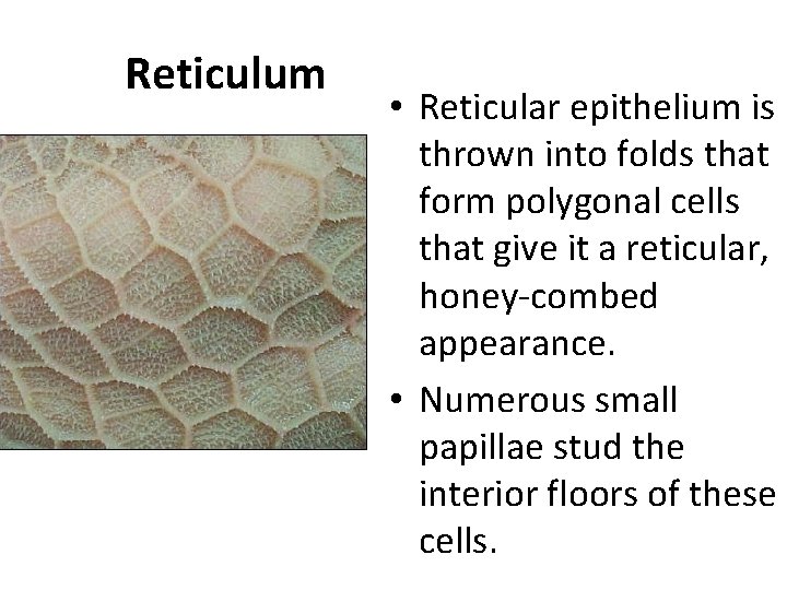 Reticulum • Reticular epithelium is thrown into folds that form polygonal cells that give