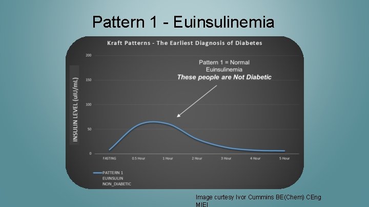 Pattern 1 - Euinsulinemia Image curtesy Ivor Cummins BE(Chem) CEng MIEI 