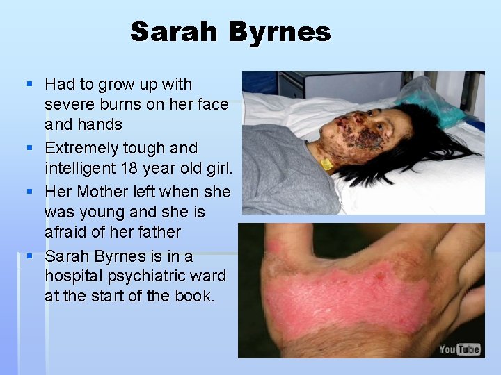 Sarah Byrnes § Had to grow up with severe burns on her face and