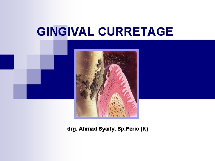 GINGIVAL CURRETAGE drg. Ahmad Syaify, Sp. Perio (K) 