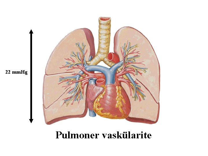 22 mm. Hg Pulmoner vaskülarite 