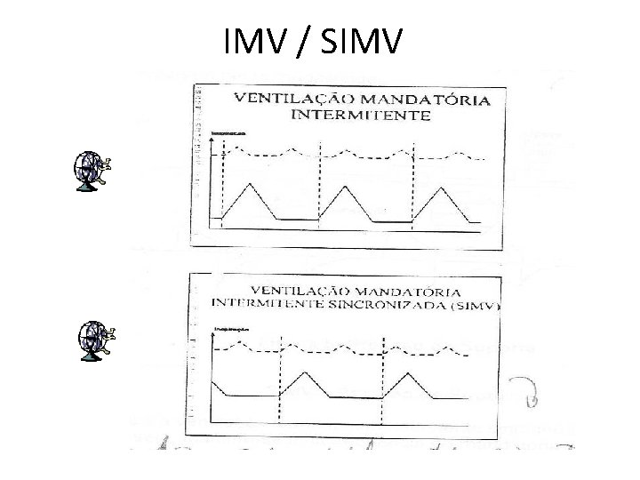 IMV / SIMV 