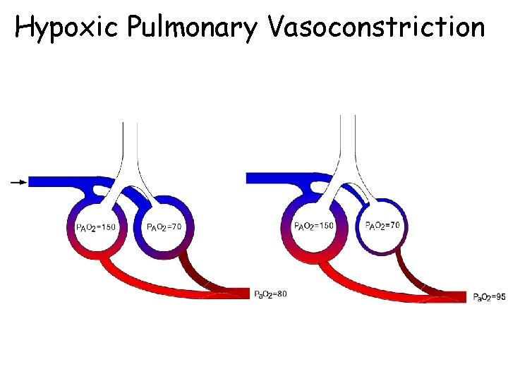 Hypoxic Pulmonary Vasoconstriction 