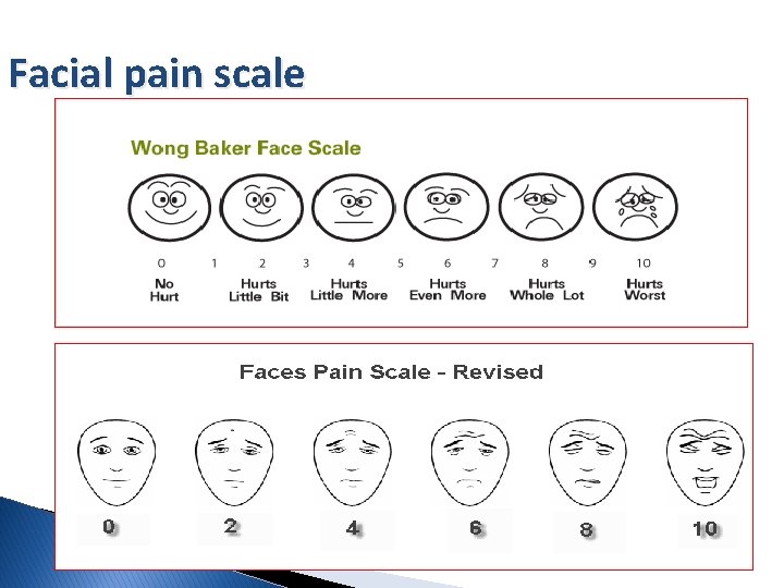 Facial pain scale 