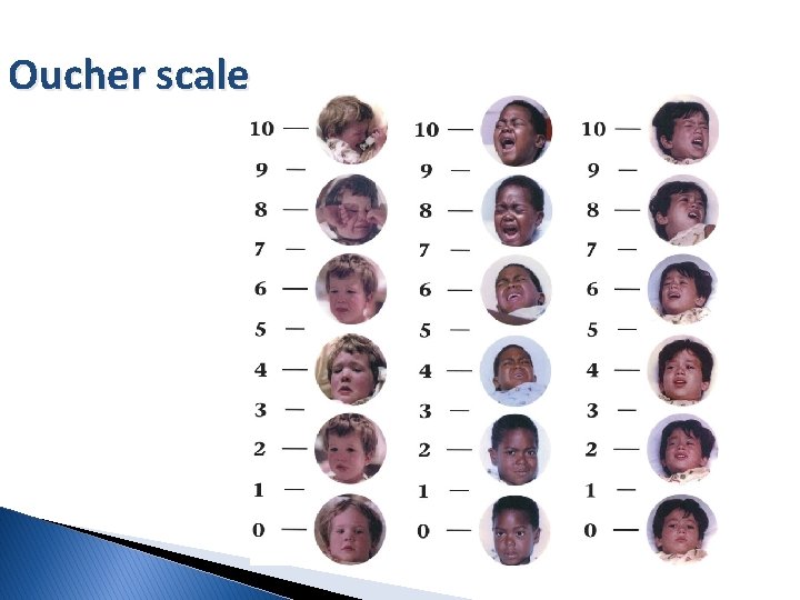 Oucher scale 