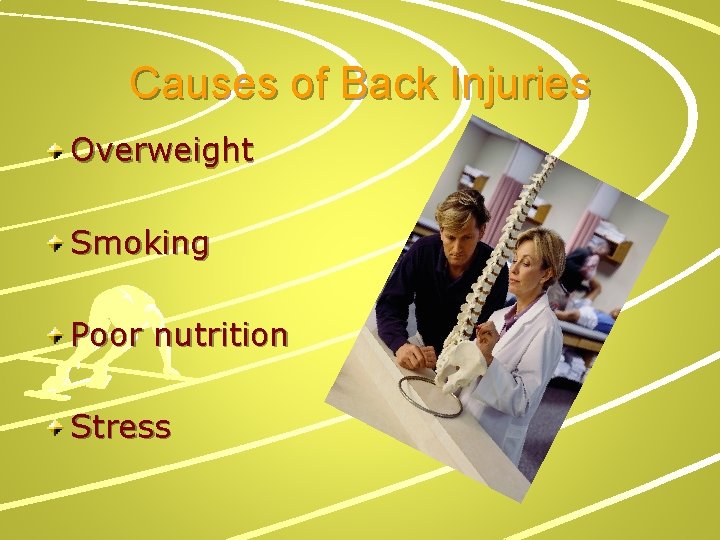 Causes of Back Injuries Overweight Smoking Poor nutrition Stress 