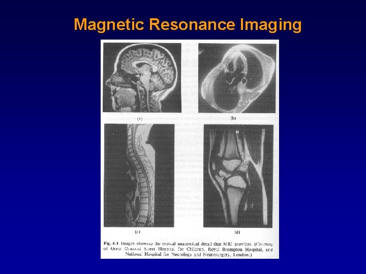 Magnetic Resonance Imaging 