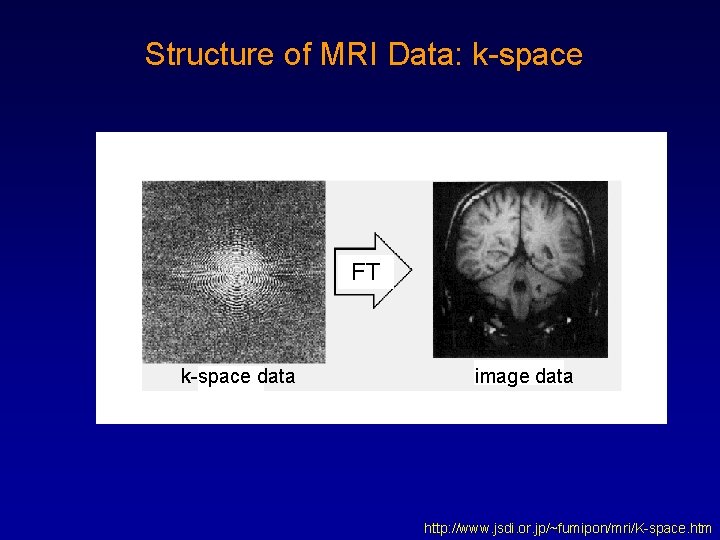 Structure of MRI Data: k-space FT k-space data image data http: //www. jsdi. or.