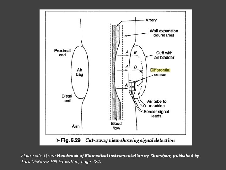 Figure cited from Handbook of Biomedical Instrumentation by Khandpur, published by Tata Mc. Graw-Hill