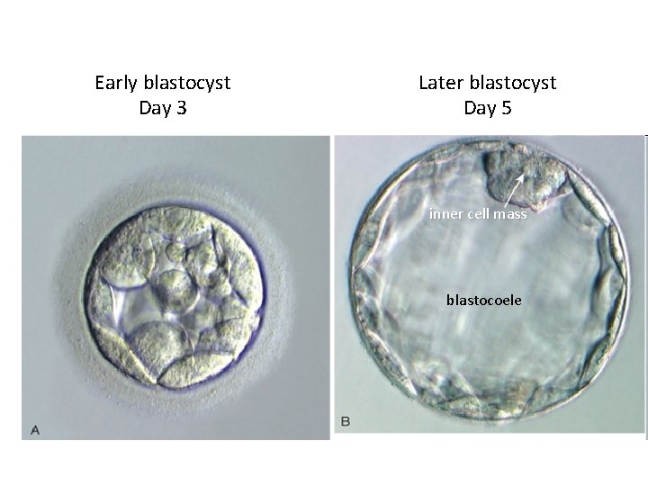 Early blastocyst Day 3 Later blastocyst Day 5 inner cell mass blastocoele 