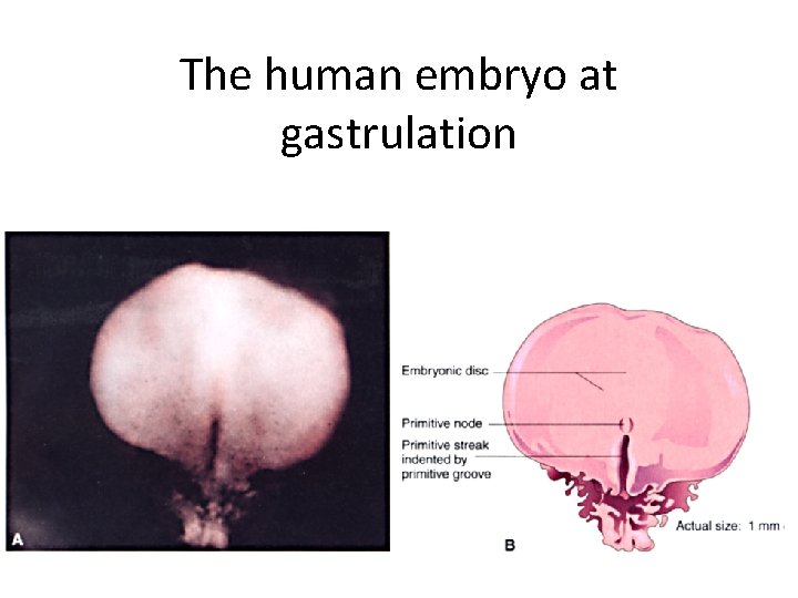 The human embryo at gastrulation 