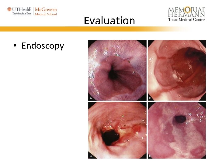 Evaluation • Endoscopy 