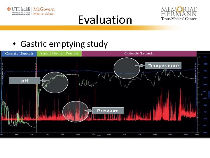 Evaluation • Gastric emptying study 